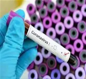Activities Related to Coronavirus Which Has Been Done By The Tabriz Faculty of Nursing and Midwifery (March to April, 2020)